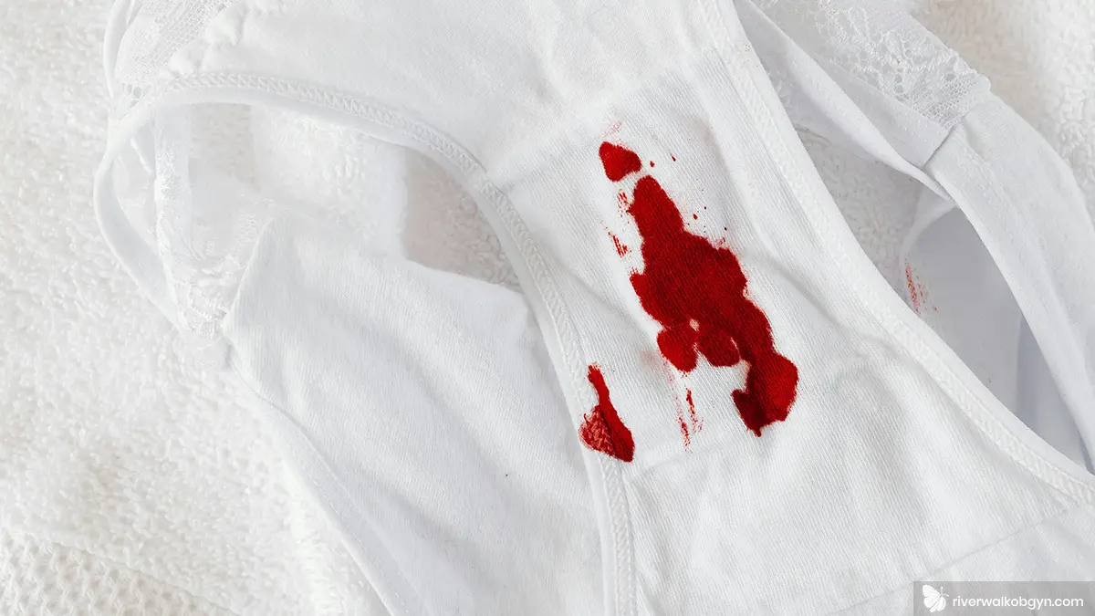 Sporadic Spotting Between Periods | Riverwalk Women's Health San Antonio